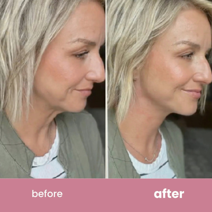 QuickLift Neck Tape
