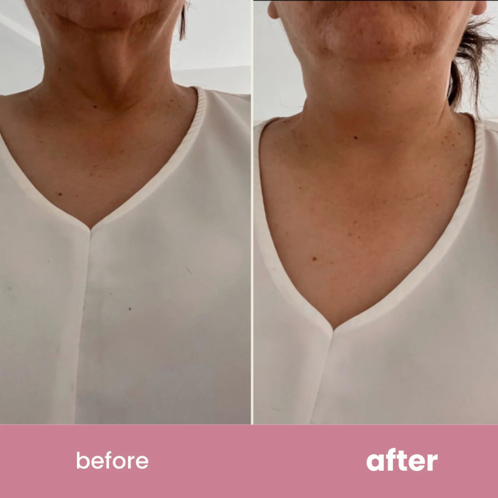 QuickLift Neck Tape